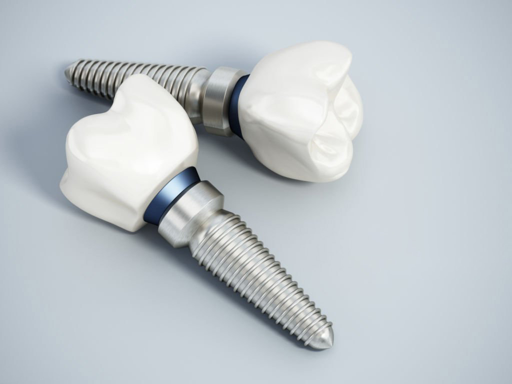 Primer plano de dos implantes dentales completos con corona, sobre fondo gris neutro.